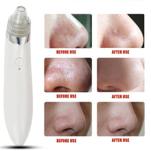 Load image into Gallery viewer, Electric Facial Skin Care Pore Blackhead Remover Cleaner Vacuum Acne Cleanser AU